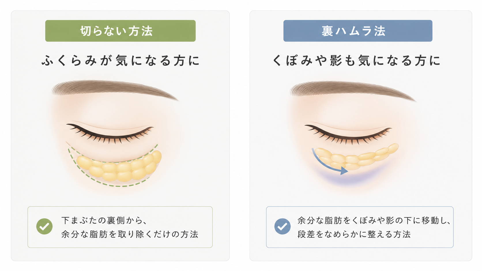 下眼瞼脱脂と裏ハムラ法の違いの図解