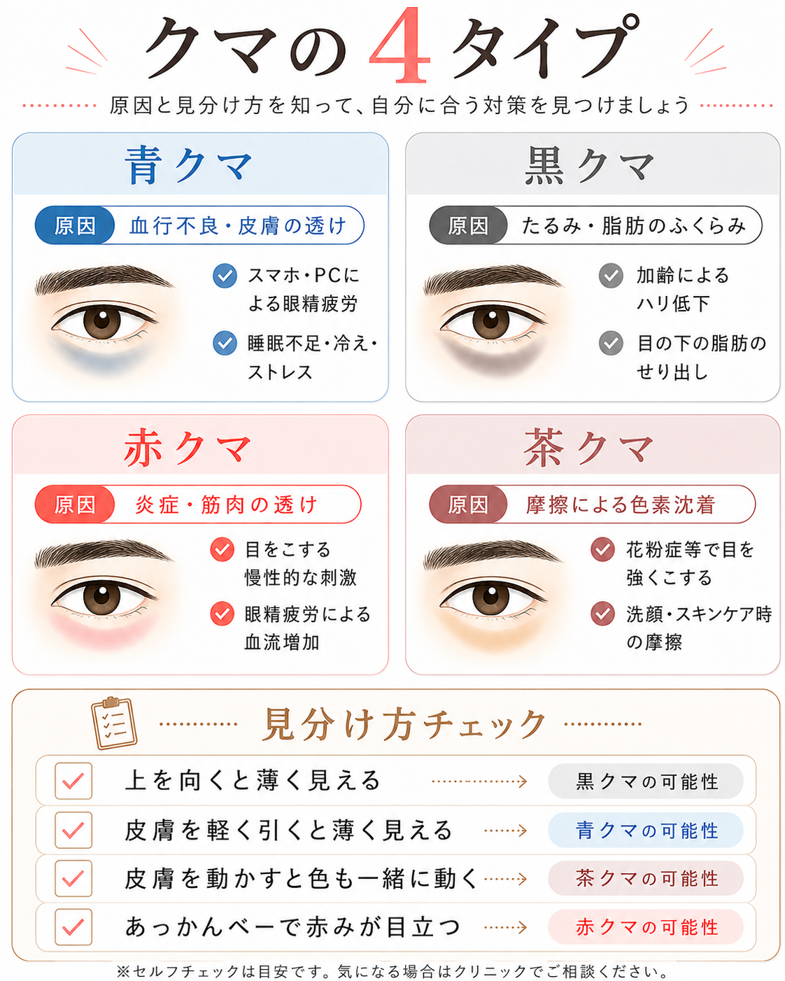 目の下のクマの4タイプ(青クマ・黒クマ・赤クマ・茶クマ)分類図